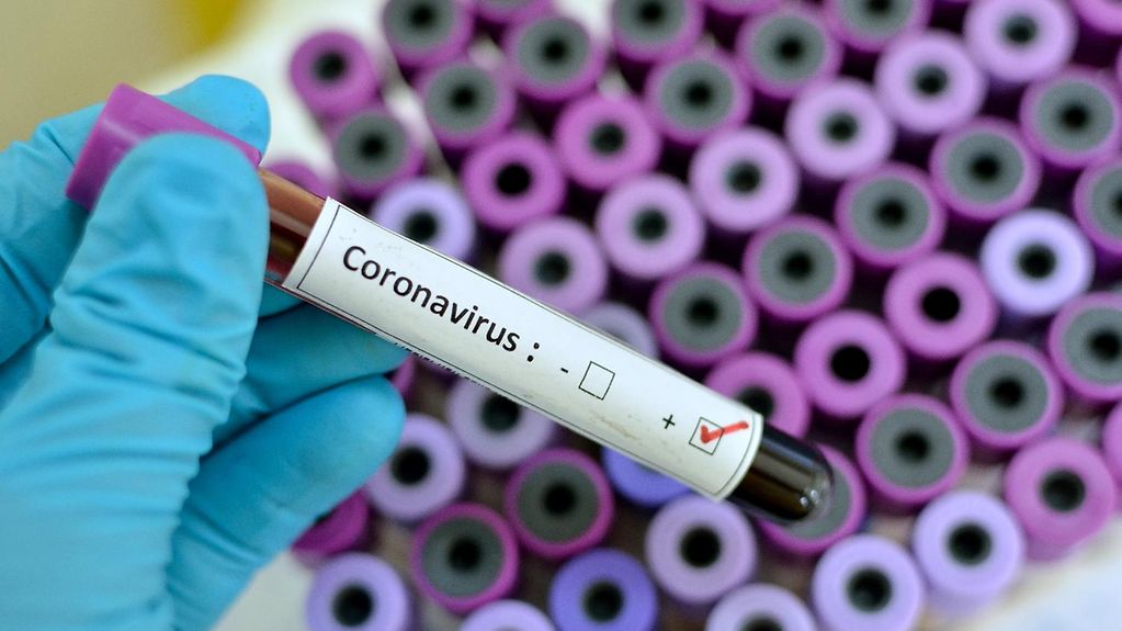 Koronavirüs Pozitif